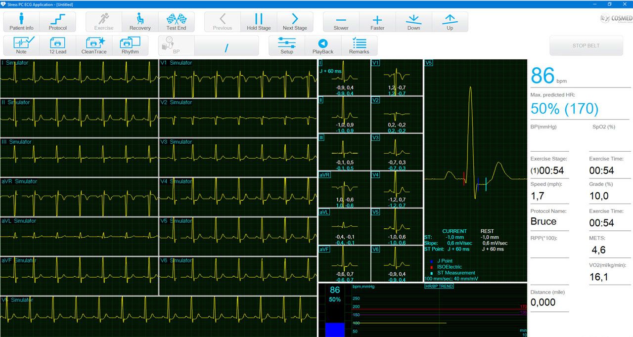 Epreuve d'effort Cardio monitor